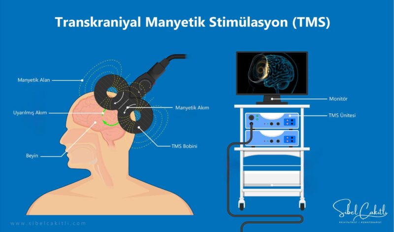 Tams Tedavisinde Kanıtlanmış Yöntemler ve Klinik Püf Noktaları [2026] - Kapak Görseli